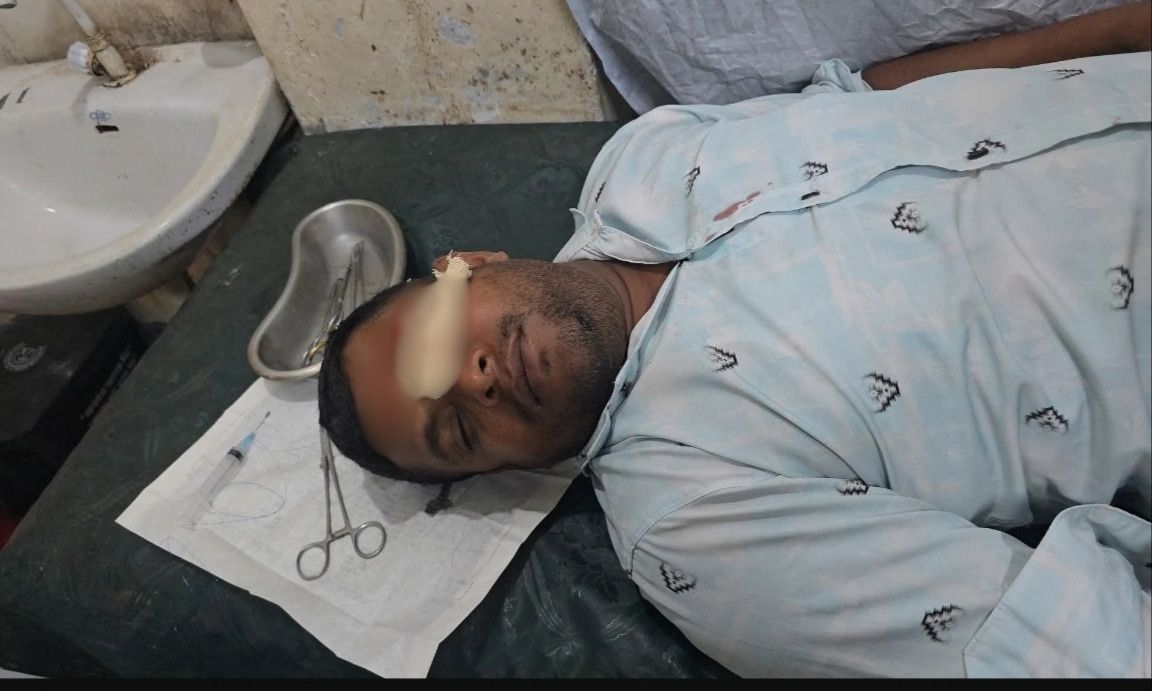 রূপগঞ্জে সংবাদ প্রকাশের জেরে সাংবাদিকের ওপর হামলার অভিযোগ